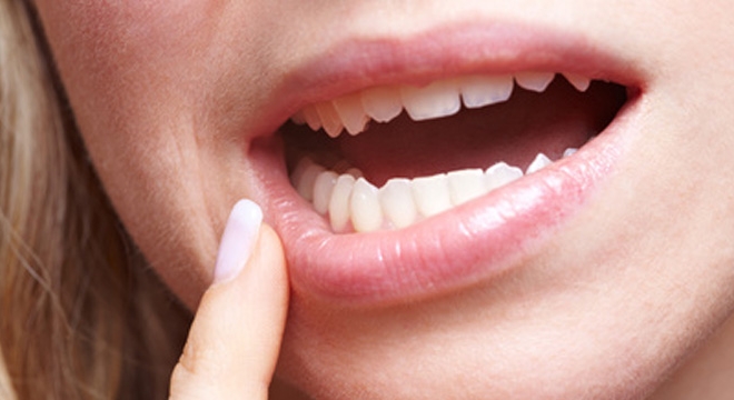 TMJ therapy
